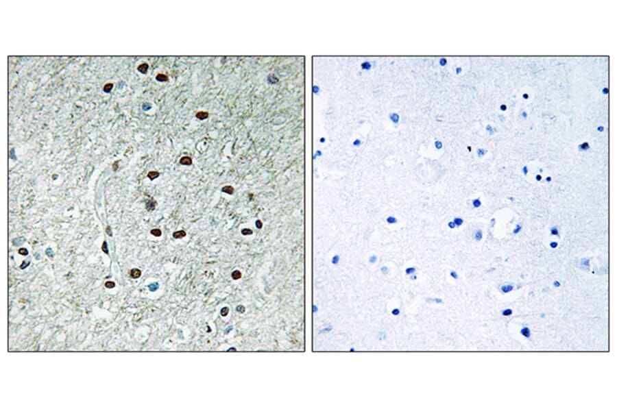 Immunohistochemistry - Anti-REXO1 Antibody (C18445) - Antibodies.com