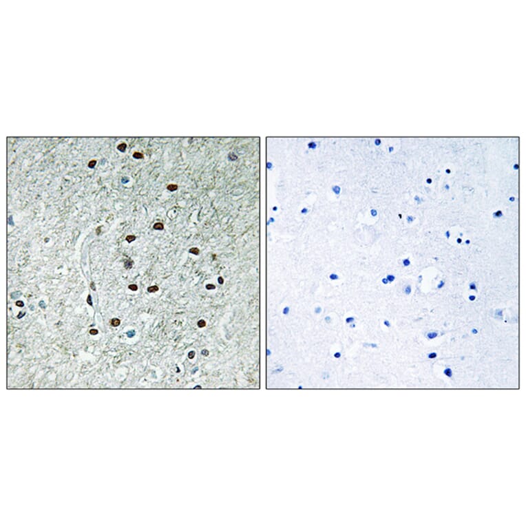 Immunohistochemistry - Anti-REXO1 Antibody (C18445) - Antibodies.com