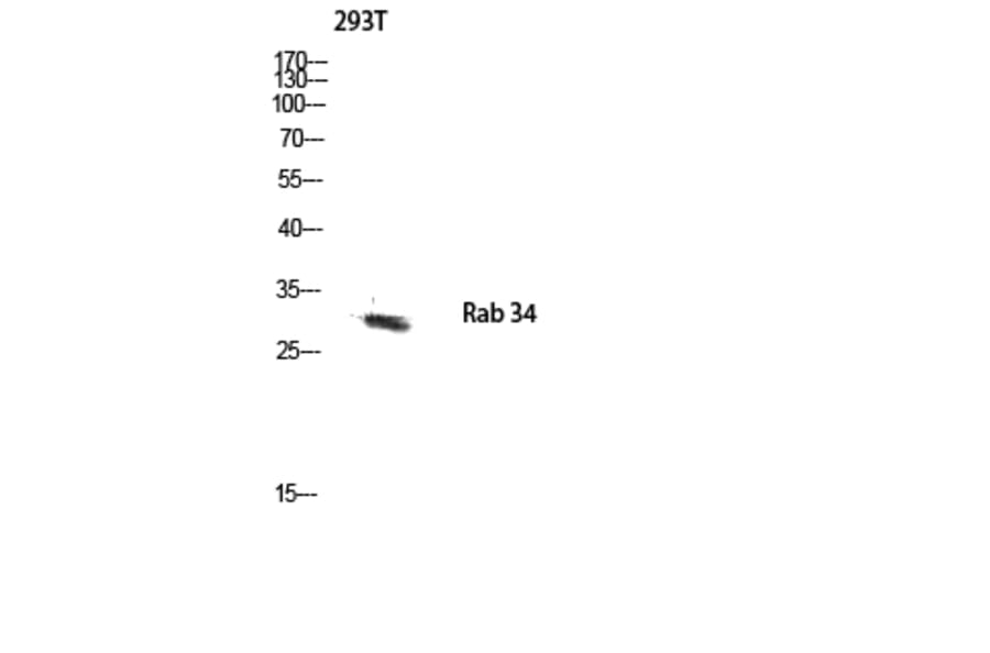 Western Blot - Anti-RAB34 Antibody (C18244) - Antibodies.com