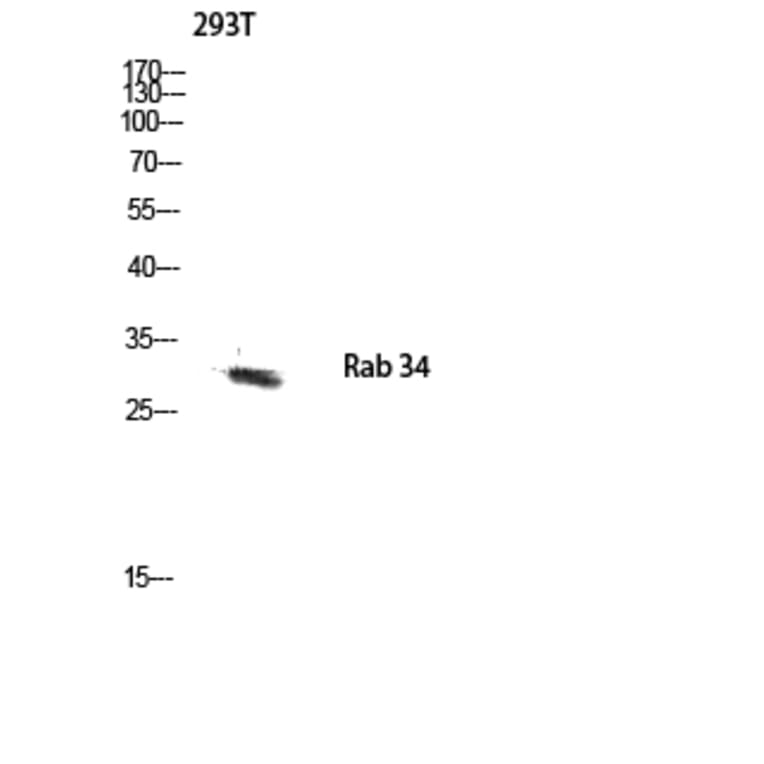 Western Blot - Anti-RAB34 Antibody (C18244) - Antibodies.com
