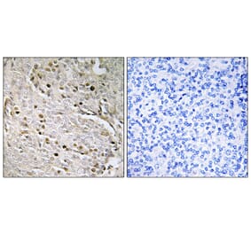 Immunohistochemistry - Anti-POTE8 Antibody (C17980) - Antibodies.com