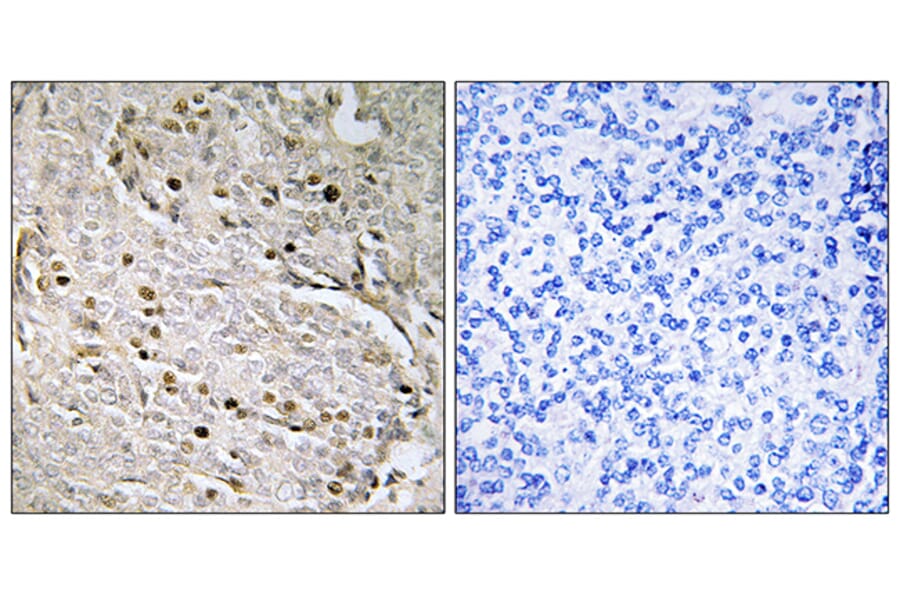 Immunohistochemistry - Anti-POTE8 Antibody (C17980) - Antibodies.com