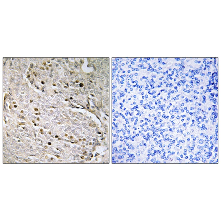 Immunohistochemistry - Anti-POTE8 Antibody (C17980) - Antibodies.com