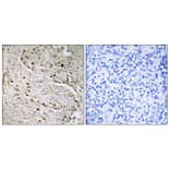 Immunohistochemistry - Anti-POTE8 Antibody (C17980) - Antibodies.com