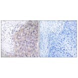 Immunohistochemistry - Anti-POLG2 Antibody (C15431) - Antibodies.com