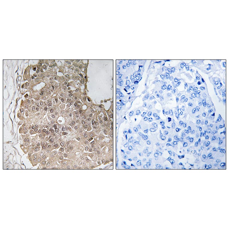 Immunohistochemistry - Anti-PARP4 Antibody (C13099) - Antibodies.com