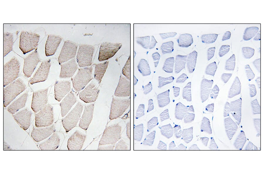 Immunohistochemistry - Anti-MYOM1 Antibody (C16759) - Antibodies.com