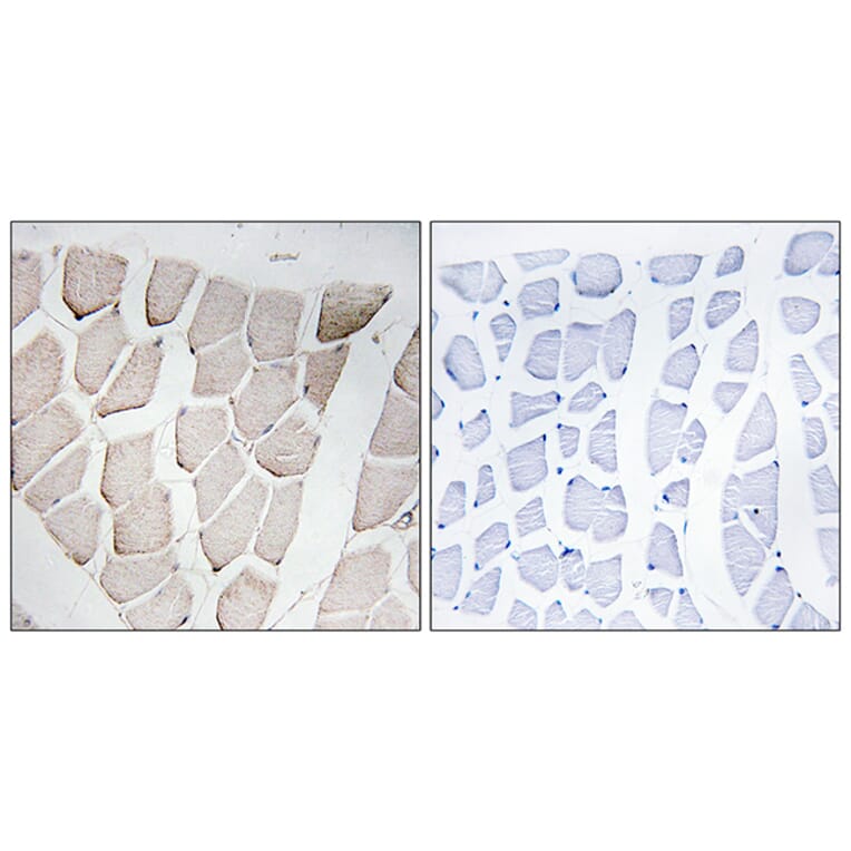 Immunohistochemistry - Anti-MYOM1 Antibody (C16759) - Antibodies.com