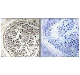 Immunohistochemistry - Anti-MRPS5 Antibody (C16664) - Antibodies.com