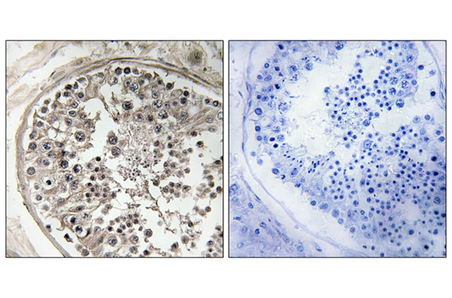 Immunohistochemistry - Anti-MRPS5 Antibody (C16664) - Antibodies.com