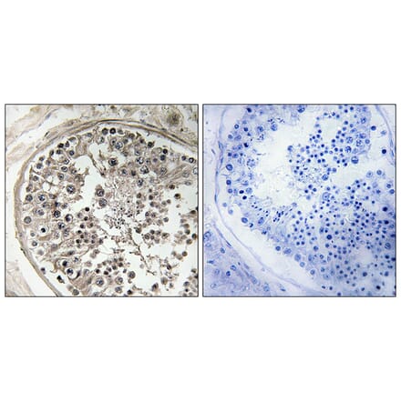 Immunohistochemistry - Anti-MRPS5 Antibody (C16664) - Antibodies.com