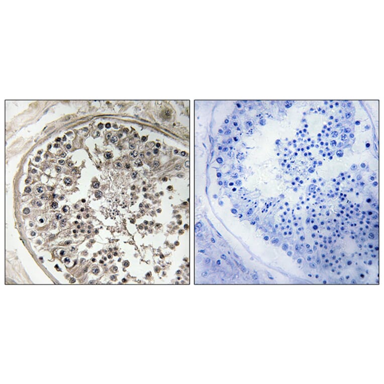 Immunohistochemistry - Anti-MRPS5 Antibody (C16664) - Antibodies.com