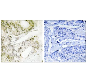 Immunohistochemistry - Anti-MED13 Antibody (C11850) - Antibodies.com