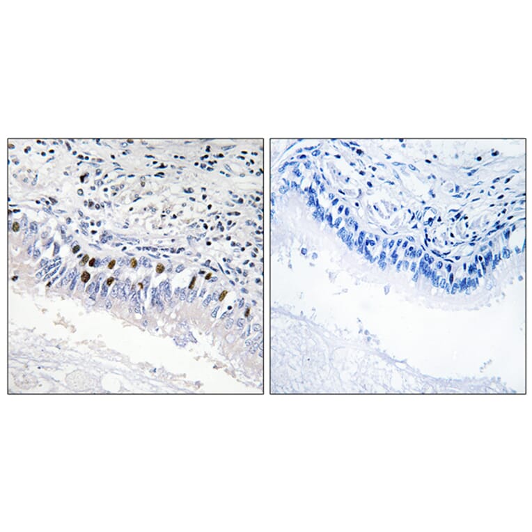 Immunohistochemistry - Anti-MED12 Antibody (C11455) - Antibodies.com