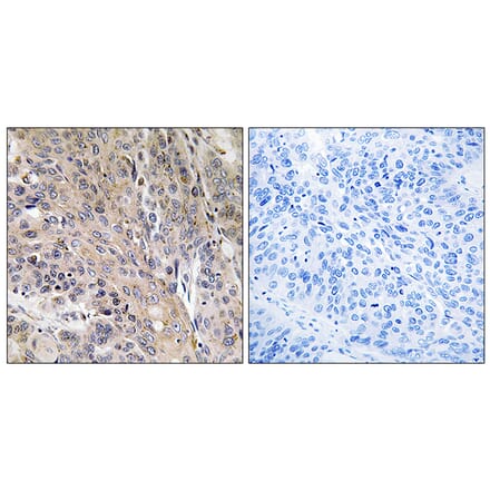 Immunohistochemistry - Anti-LAMP3 Antibody (C16533) - Antibodies.com