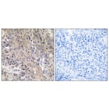 Immunohistochemistry - Anti-LAMP3 Antibody (C16533) - Antibodies.com