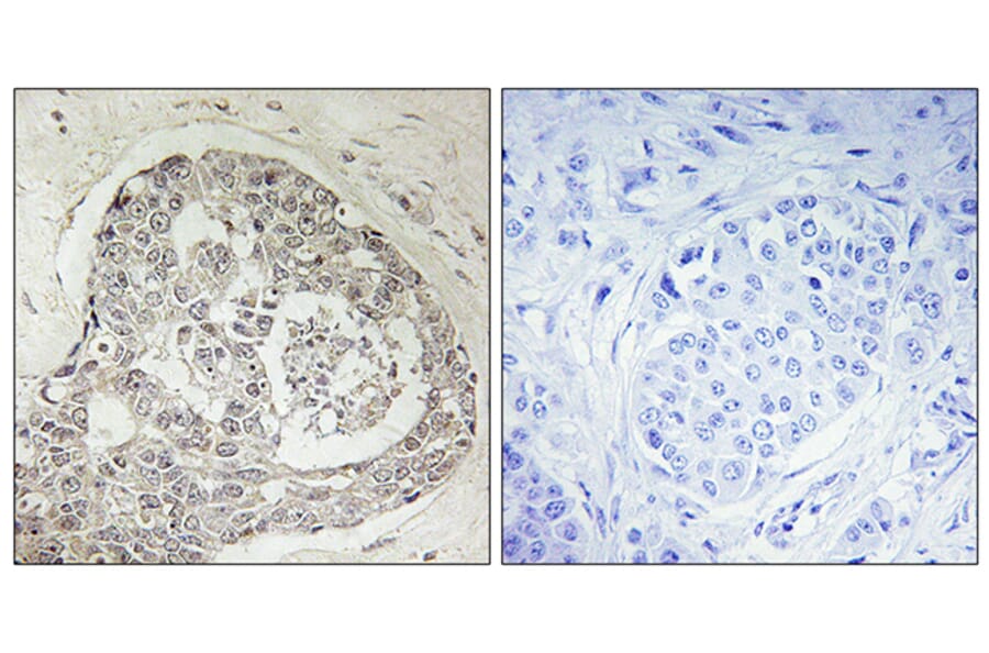 Immunohistochemistry - Anti-K0100 Antibody (C11042) - Antibodies.com