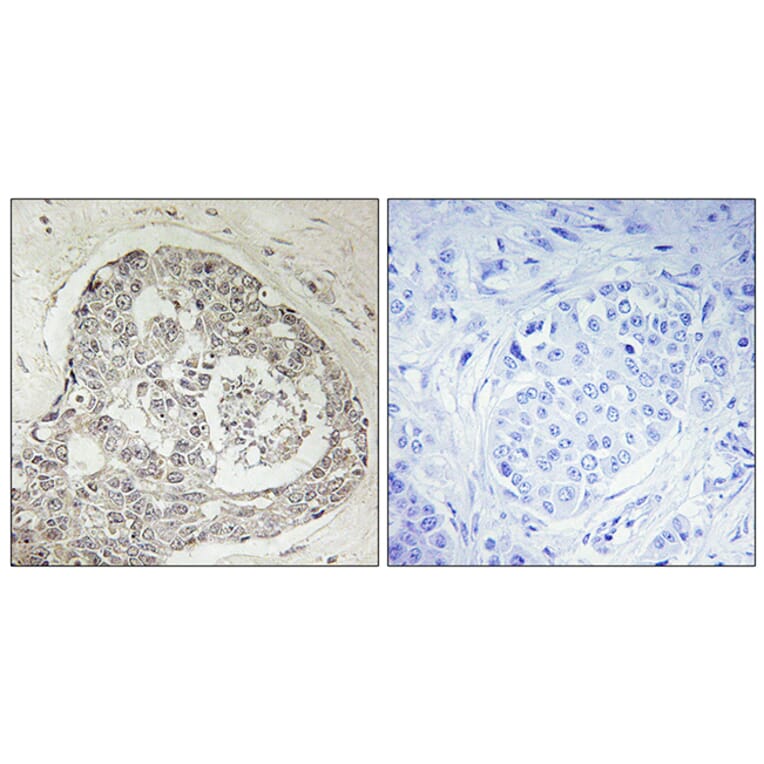 Immunohistochemistry - Anti-K0100 Antibody (C11042) - Antibodies.com