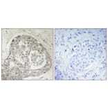 Immunohistochemistry - Anti-K0100 Antibody (C11042) - Antibodies.com