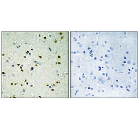 Immunohistochemistry - Anti-JHD3B Antibody (C10209) - Antibodies.com