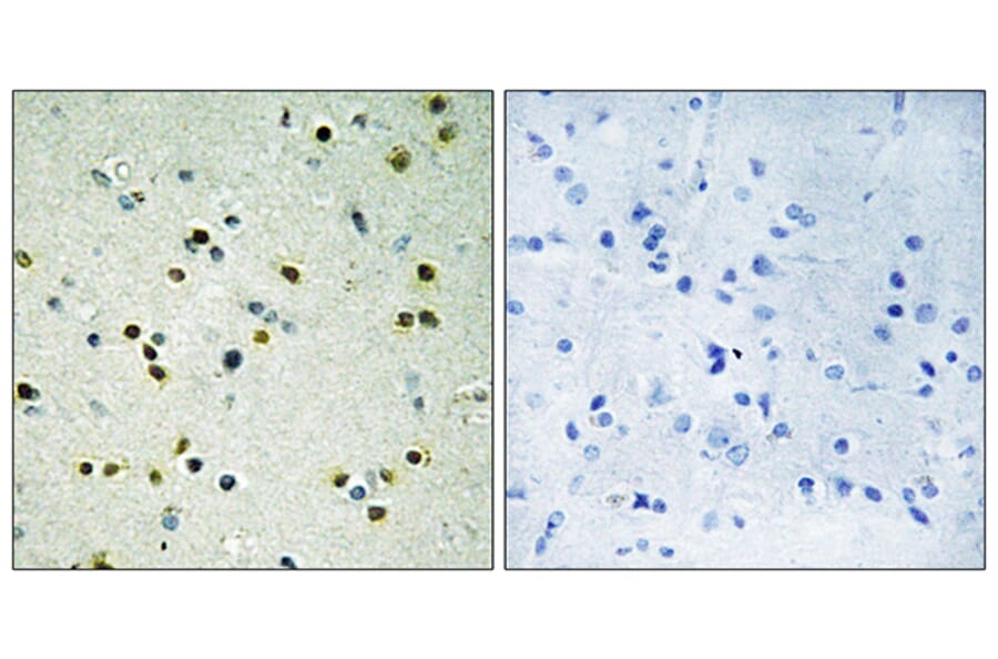 Immunohistochemistry - Anti-JHD3B Antibody (C10209) - Antibodies.com