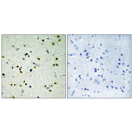 Immunohistochemistry - Anti-JHD3B Antibody (C10209) - Antibodies.com