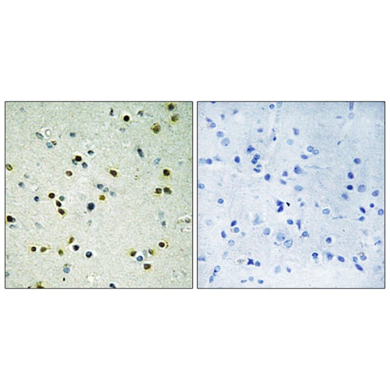 Immunohistochemistry - Anti-JHD3B Antibody (C10209) - Antibodies.com