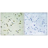 Immunohistochemistry - Anti-JHD3B Antibody (C10209) - Antibodies.com