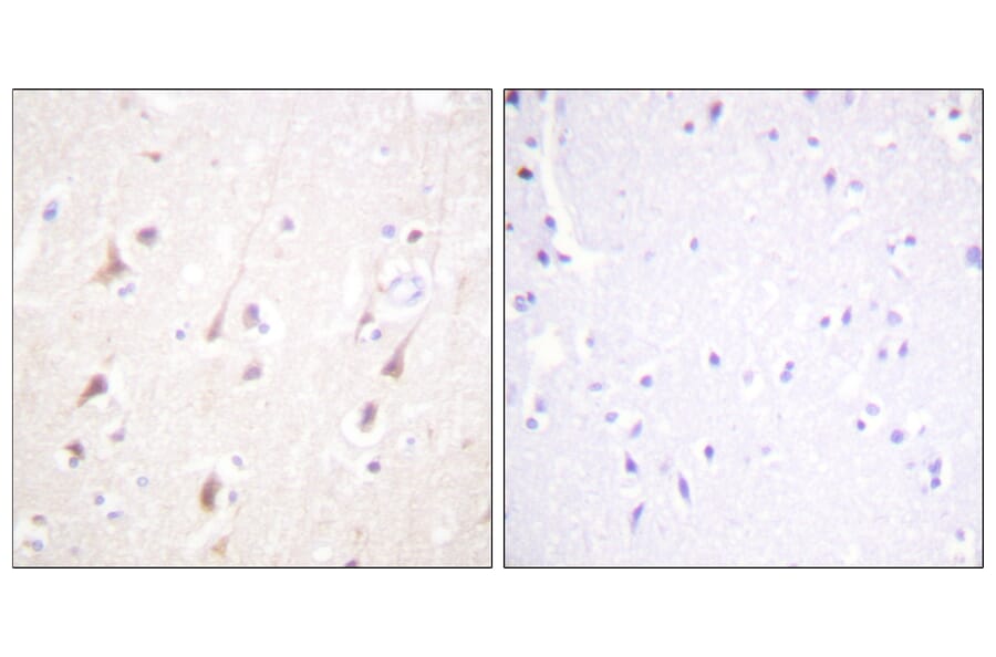 Immunohistochemistry - Anti-IRS-1 Antibody (B0668) - Antibodies.com