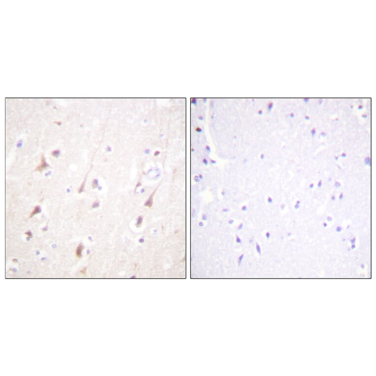 Immunohistochemistry - Anti-IRS-1 Antibody (B0668) - Antibodies.com
