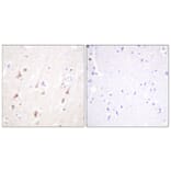 Immunohistochemistry - Anti-IRS-1 Antibody (B0668) - Antibodies.com