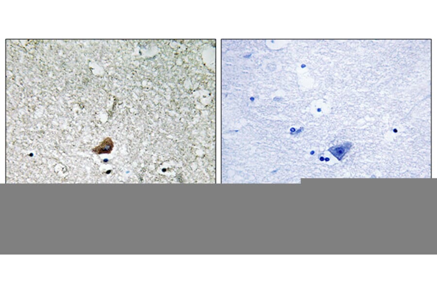 Immunohistochemistry - Anti-IRAK1 Antibody (B8117) - Antibodies.com