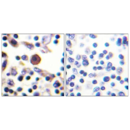 Immunohistochemistry - Anti-IL-9R Antibody (B1067) - Antibodies.com