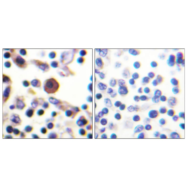 Immunohistochemistry - Anti-IL-9R Antibody (B1067) - Antibodies.com