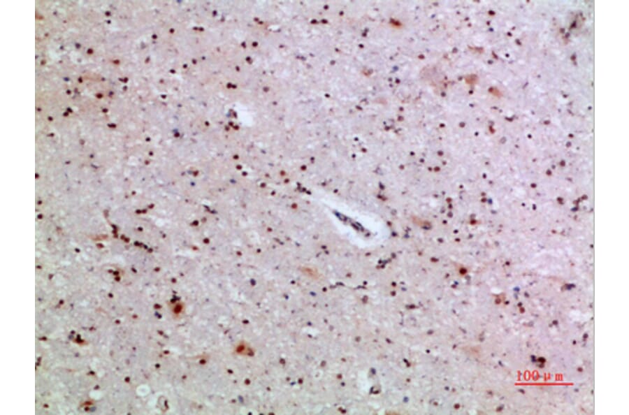 Immunohistochemistry - Anti-IL36A Antibody (C30694) - Antibodies.com