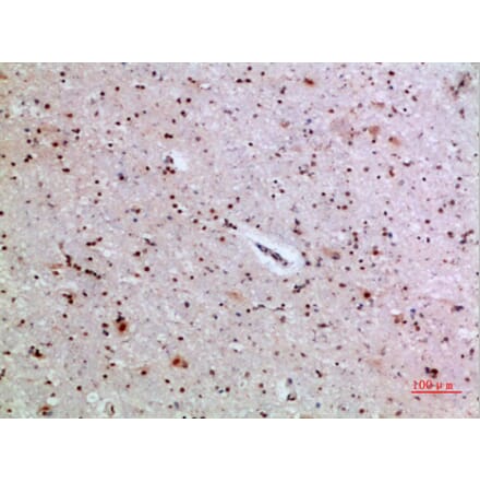 Immunohistochemistry - Anti-IL36A Antibody (C30694) - Antibodies.com