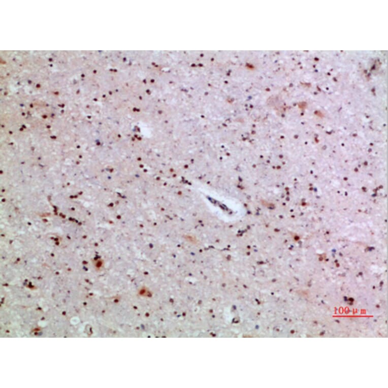 Immunohistochemistry - Anti-IL36A Antibody (C30694) - Antibodies.com