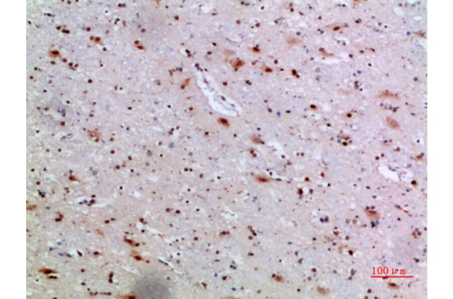 Immunohistochemistry - Anti-IL36A Antibody (C30694) - Antibodies.com