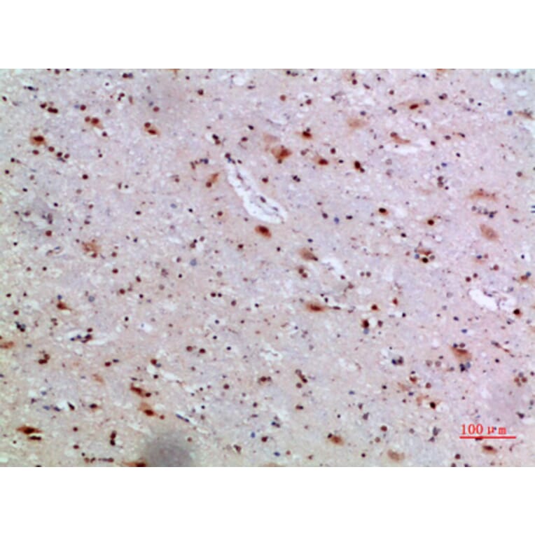 Immunohistochemistry - Anti-IL36A Antibody (C30694) - Antibodies.com