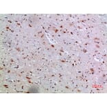 Immunohistochemistry - Anti-IL36A Antibody (C30694) - Antibodies.com