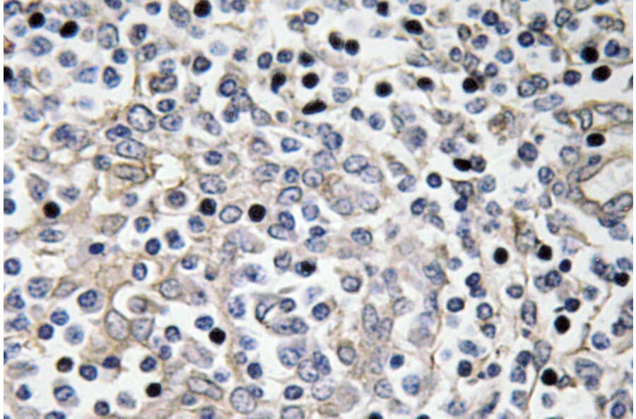 Immunohistochemistry - Anti-IL-16 Antibody (R12-2202) - Antibodies.com