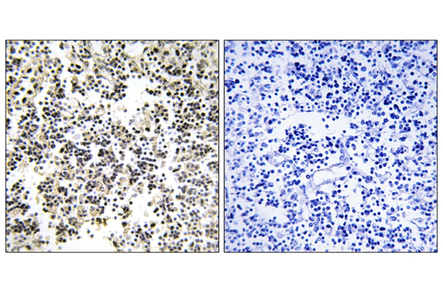 Immunohistochemistry - Anti-IGLL1 Antibody (C16372) - Antibodies.com