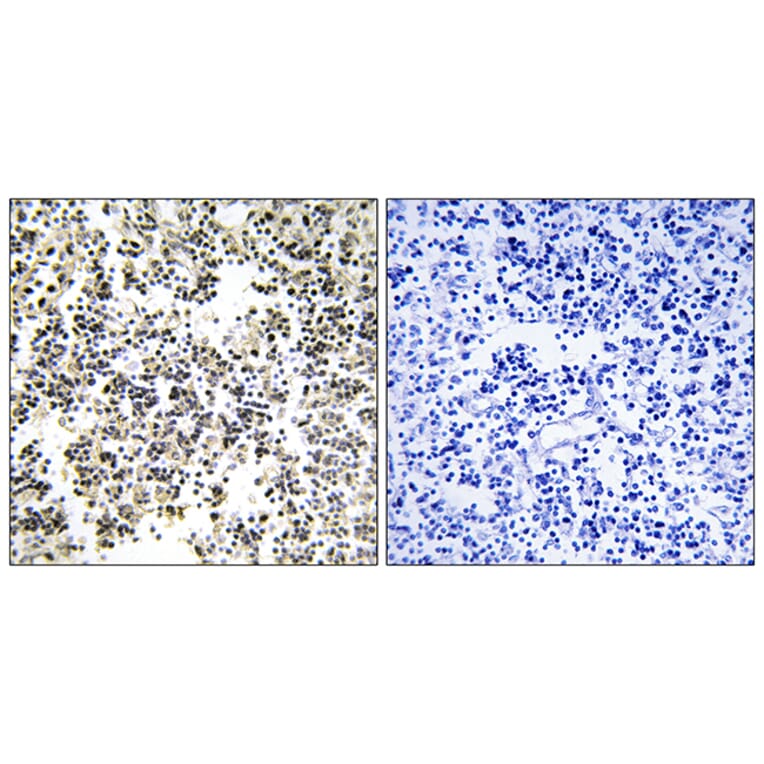 Immunohistochemistry - Anti-IGLL1 Antibody (C16372) - Antibodies.com