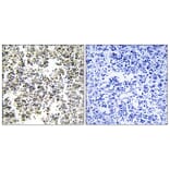 Immunohistochemistry - Anti-IGLL1 Antibody (C16372) - Antibodies.com