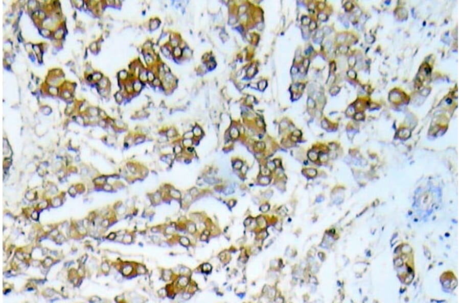 Immunohistochemistry - Anti-HSP27 Antibody (R12-2189) - Antibodies.com
