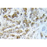 Immunohistochemistry - Anti-HSP27 Antibody (R12-2189) - Antibodies.com