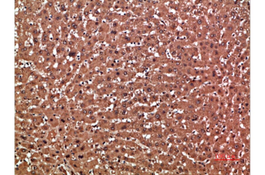 Immunohistochemistry - Anti-GSTA1 Antibody (C30817) - Antibodies.com