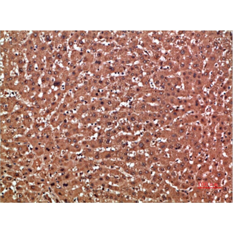 Immunohistochemistry - Anti-GSTA1 Antibody (C30817) - Antibodies.com