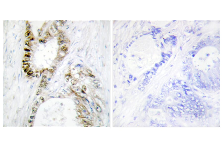 Immunohistochemistry - Anti-FANCA Antibody (B1148) - Antibodies.com