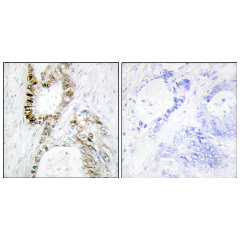 Immunohistochemistry - Anti-FANCA Antibody (B1148) - Antibodies.com